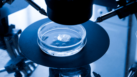 the differecnce between IVF and ICSI