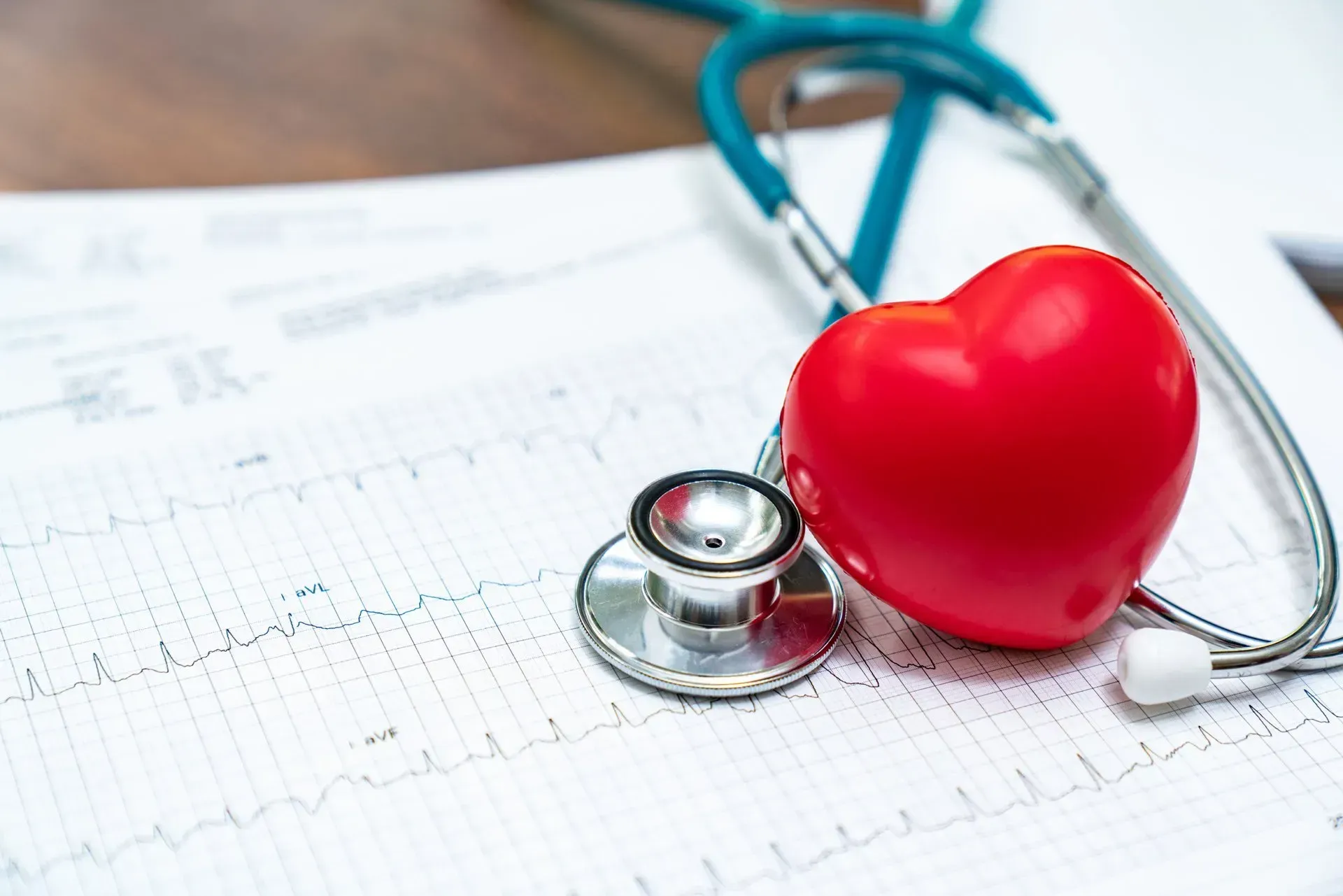 A red heart with a stethoscope attached to it is sitting on top of an electrocardiogram. A red heart with a stethoscope attached to it is sitting on top of an electrocardiogram.