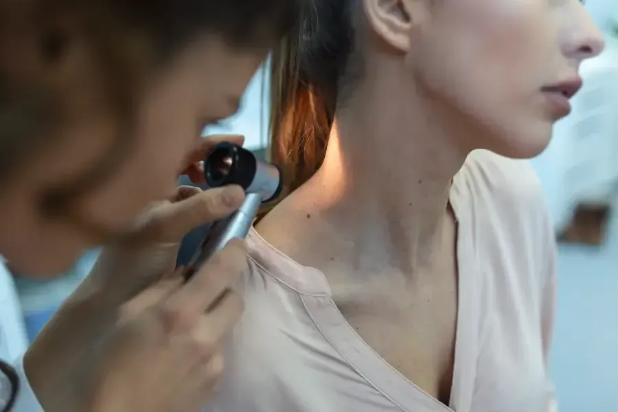 skin cancer check canberra
