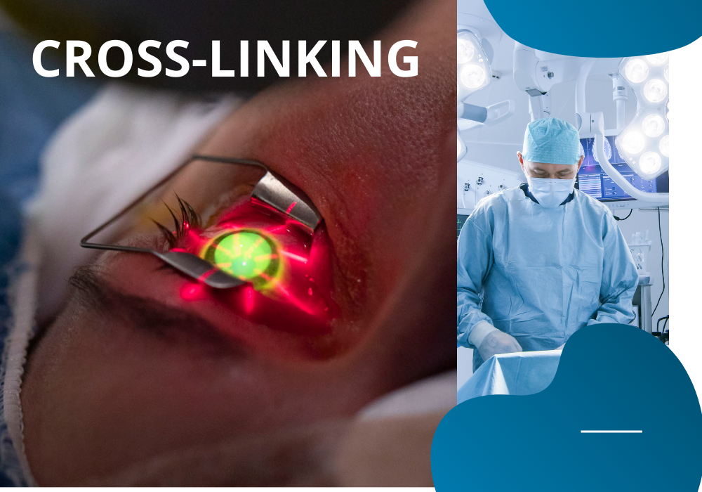 Olho de um paciente sendo submetido a tratamento de crosslinking da córnea com luz ultravioleta, ao lado de um cirurgião em uma sala de cirurgia.