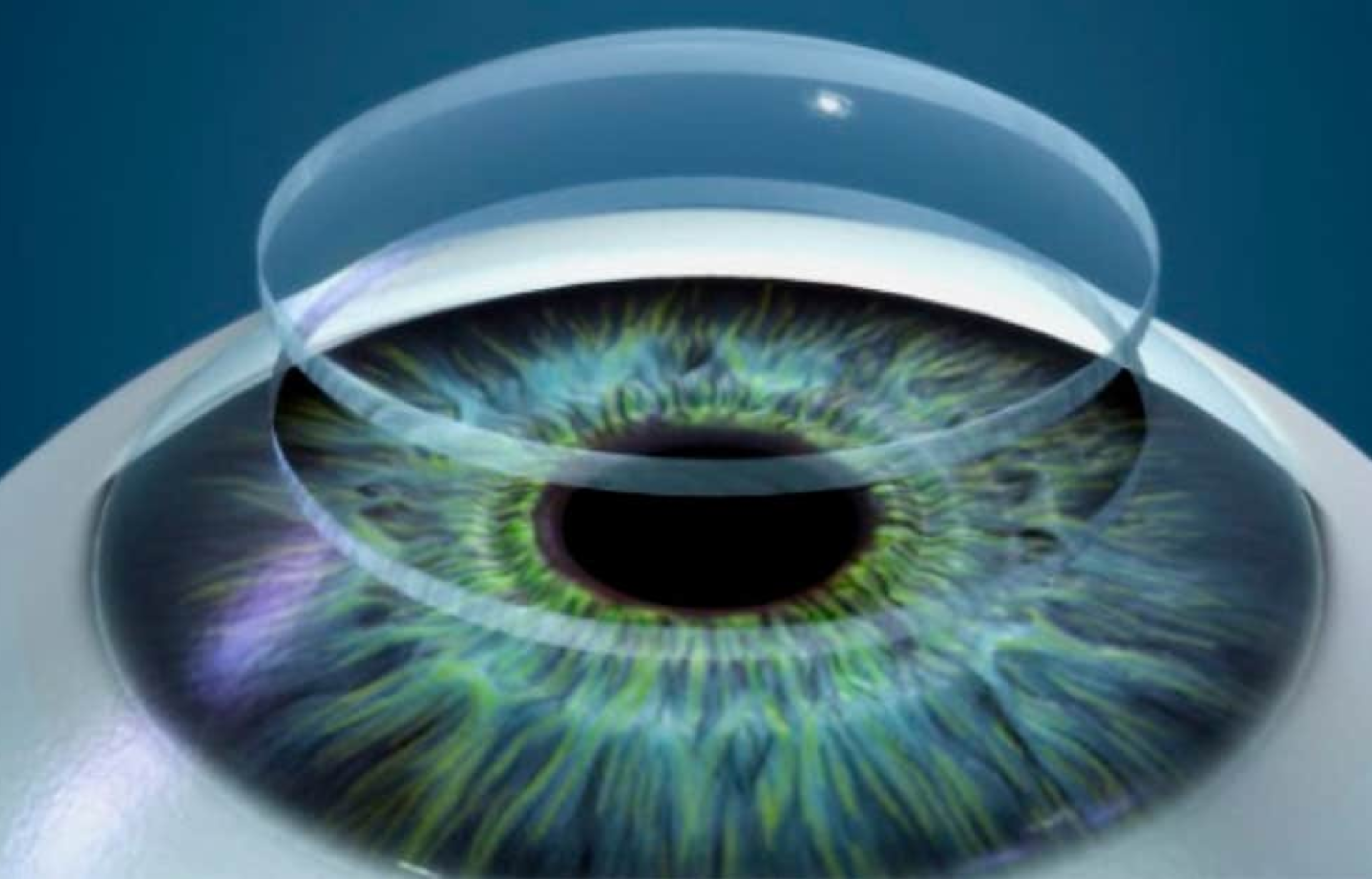 Uma lente de contato transparente pairando ligeiramente acima de um olho humano detalhado com íris verde.