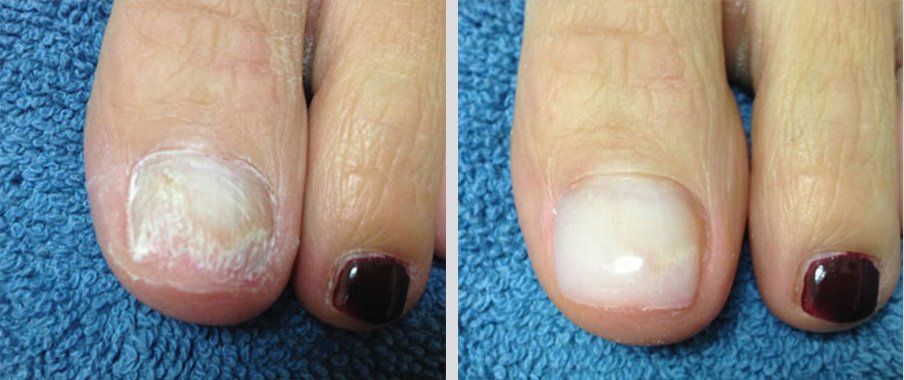 Keryflex before and after photo 18