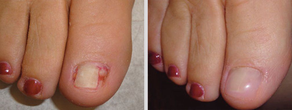 Keryflex before and after photo 3