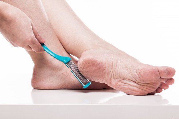 Corns and Callous Removal
