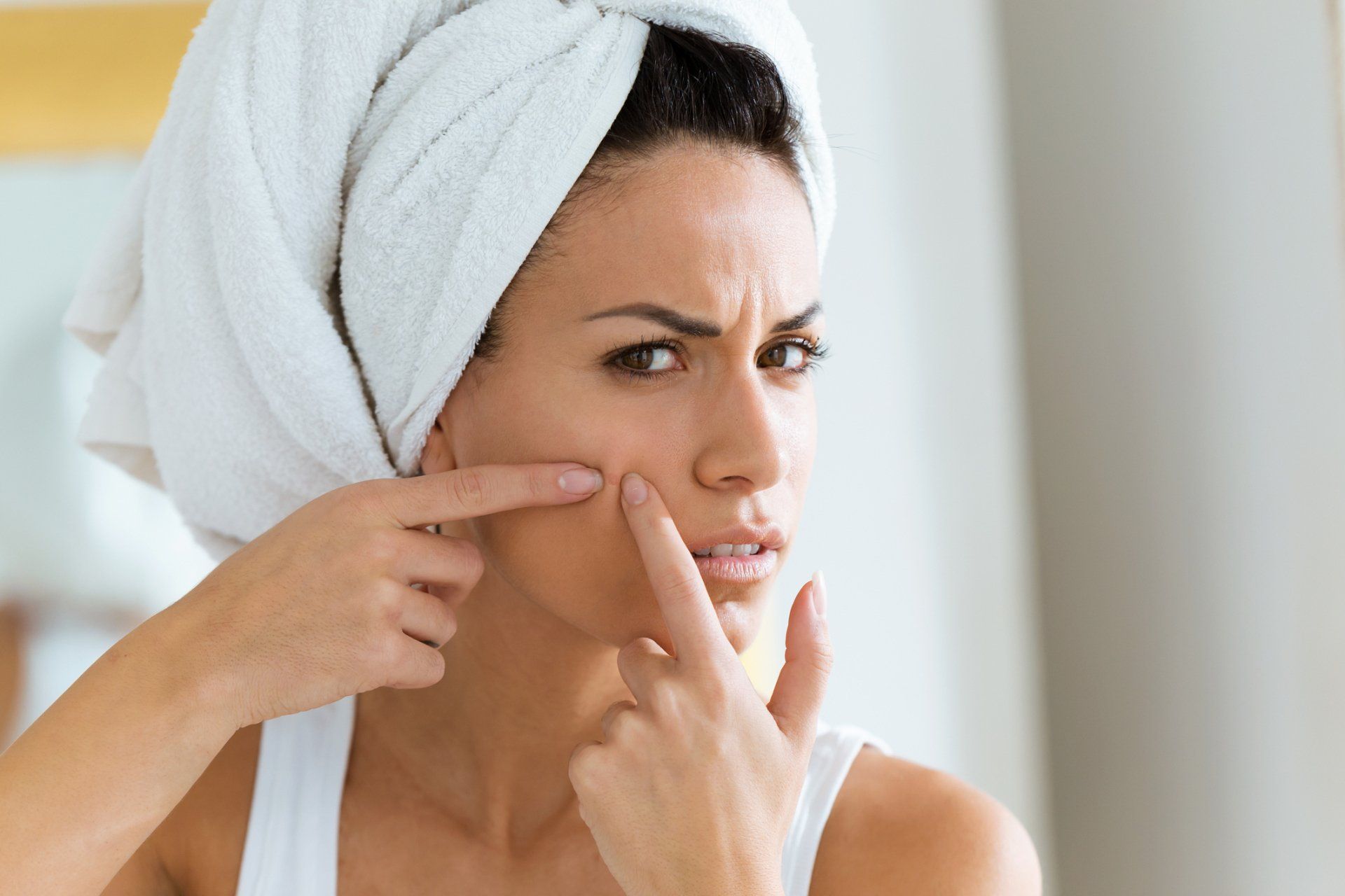 Acne Treatment — Johnson City, TN — RNA Medical Aesthetics