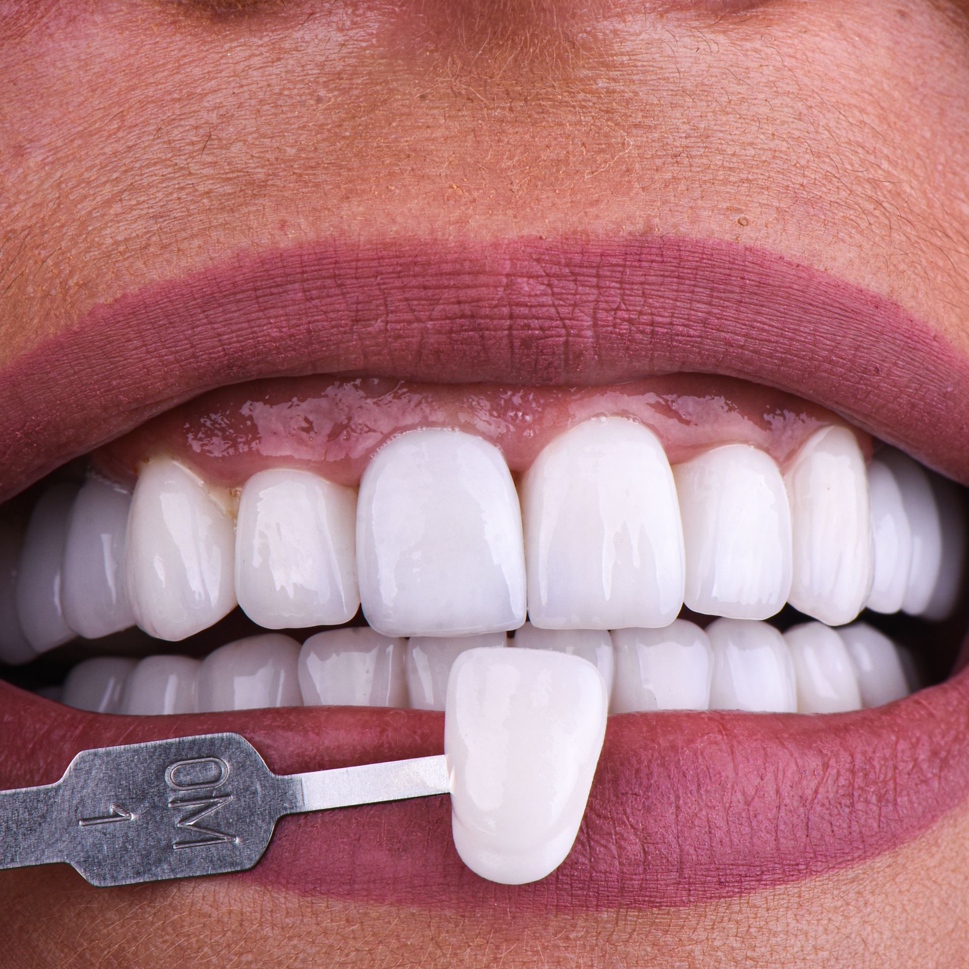 A close up of a woman 's teeth with a toothbrush in her mouth.