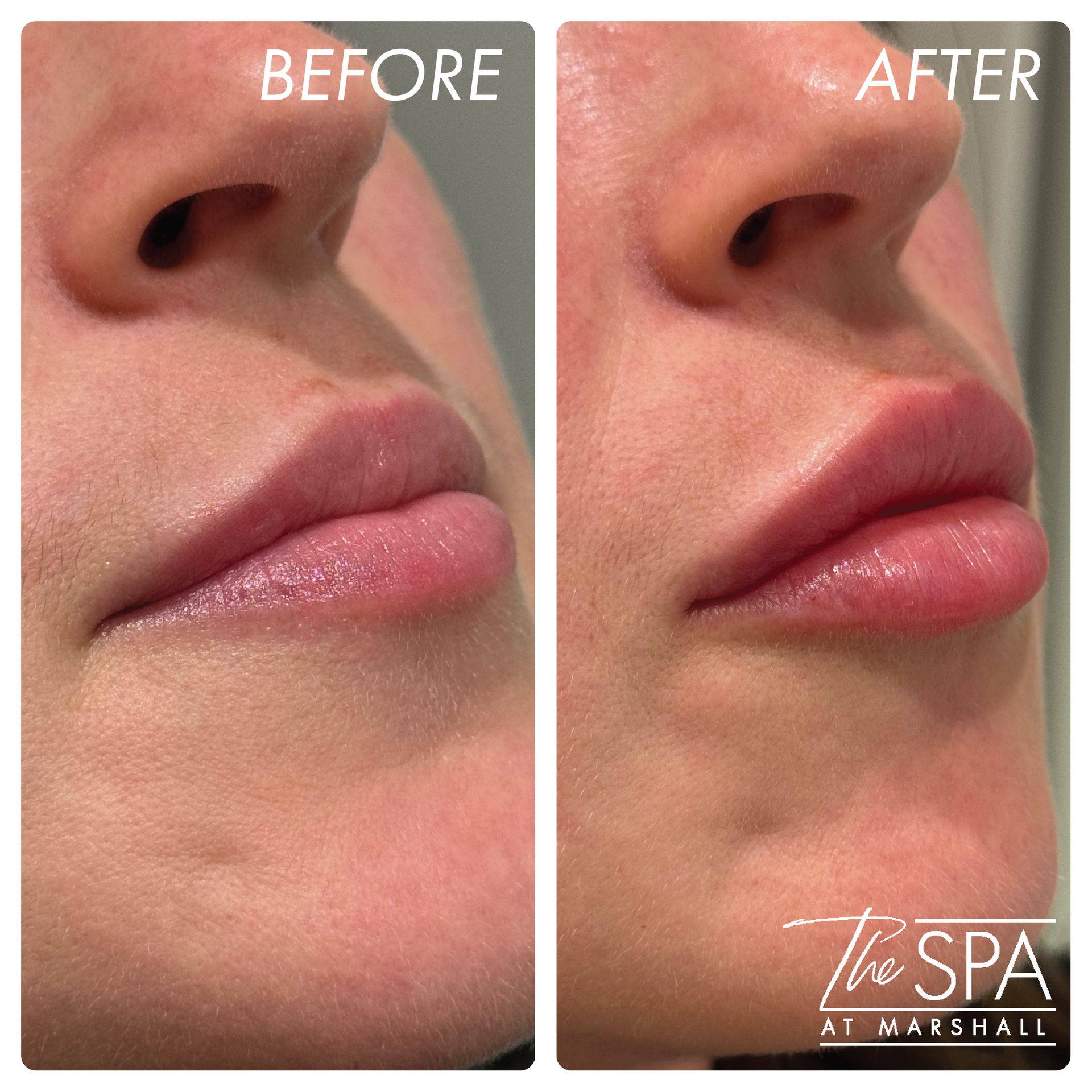 Rep Lips John Marshall Mullins, MD | The Spa at Marshall