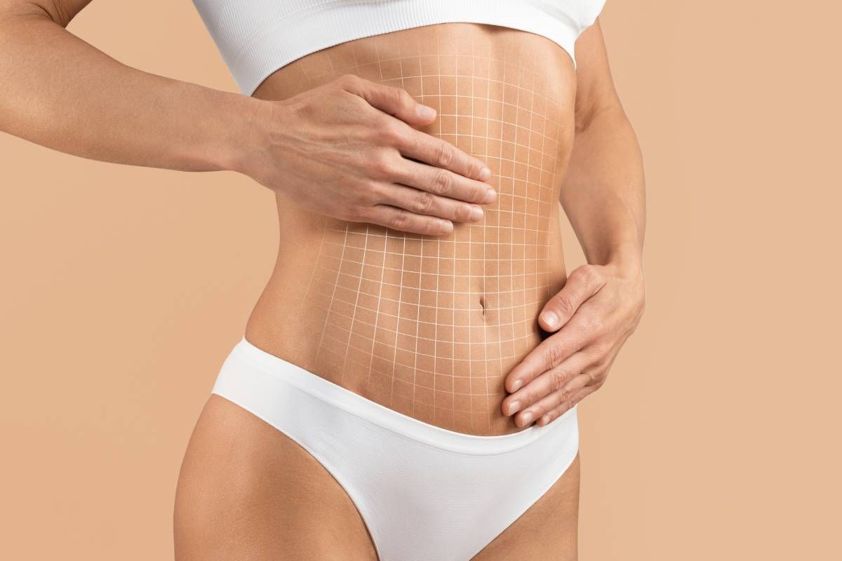 A client receiving elite CoolSculpting services near Lexington, Kentucky (KY)