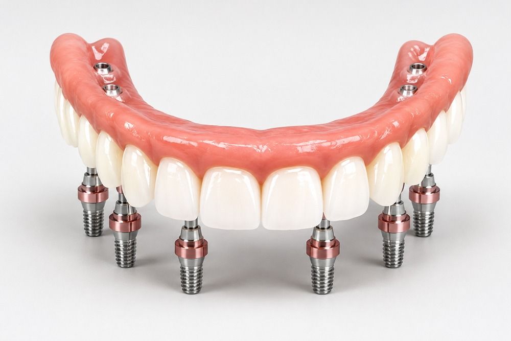 SNAP-ON DENTURES