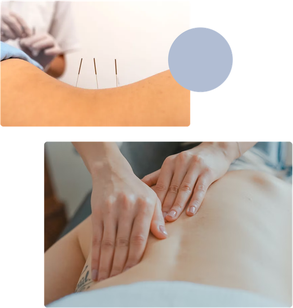 dry needling