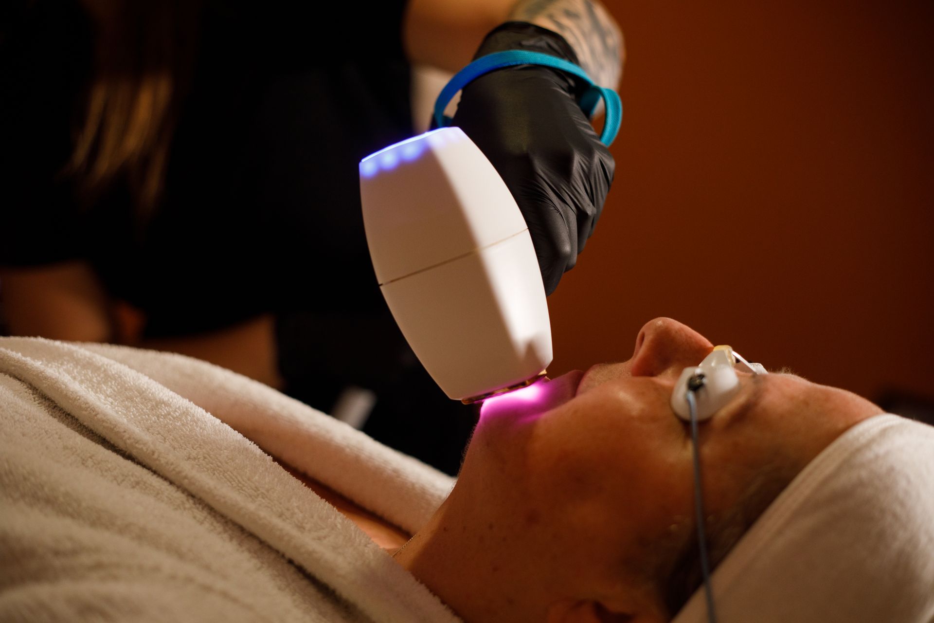 A woman receiving a Diolaze treatment