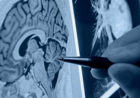 Médico neurólogo 