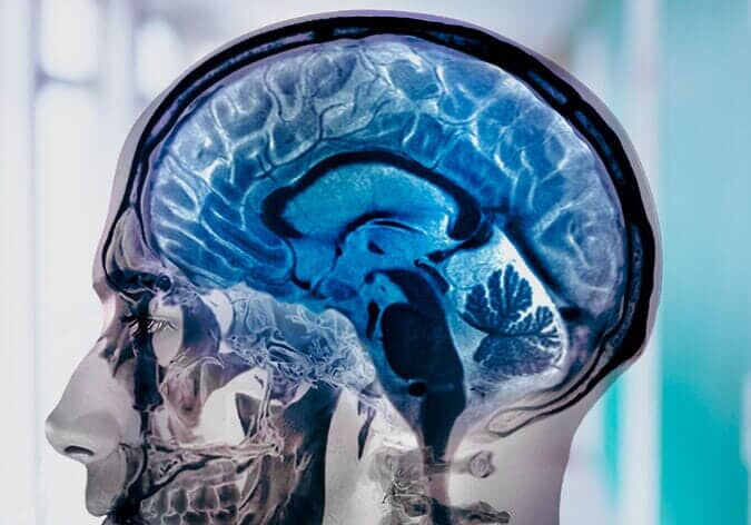 Médico neurólogo 