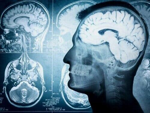 Médico neurólogo 
