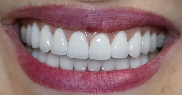 A close up of a woman 's smile with white teeth and red lips.