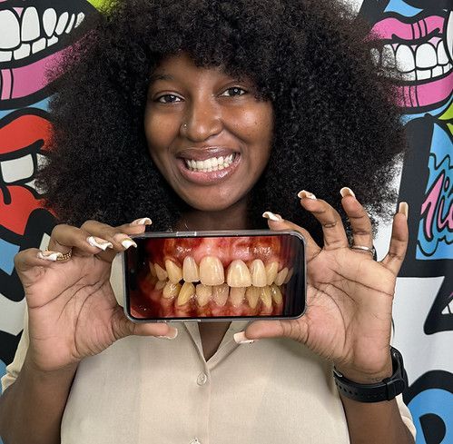 A woman is holding a cell phone with a picture of her teeth on it.