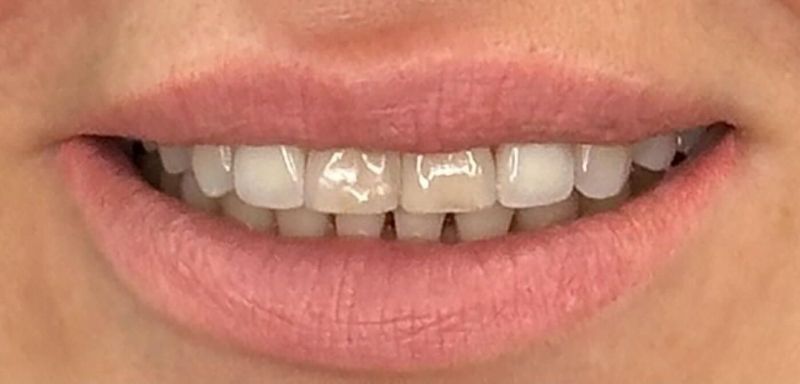 A close up of a woman 's mouth with white teeth and pink lips.