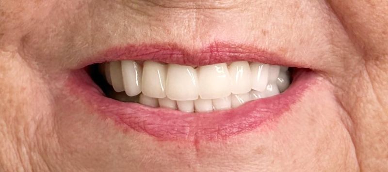 A close up of an elderly woman 's smile with white teeth and red lips.