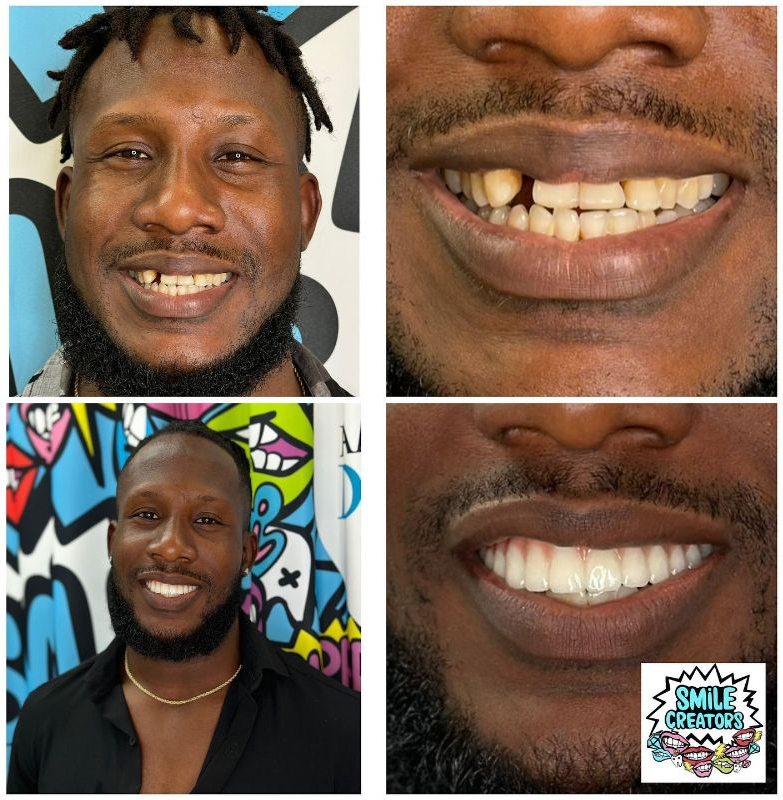 A man with a beard and missing teeth is smiling