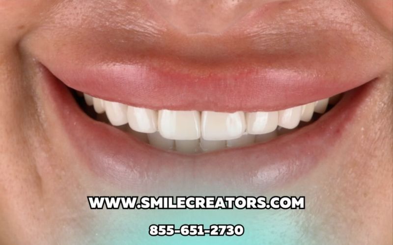 A close up of a person 's smile with the website www.smilecreators.com in the corner