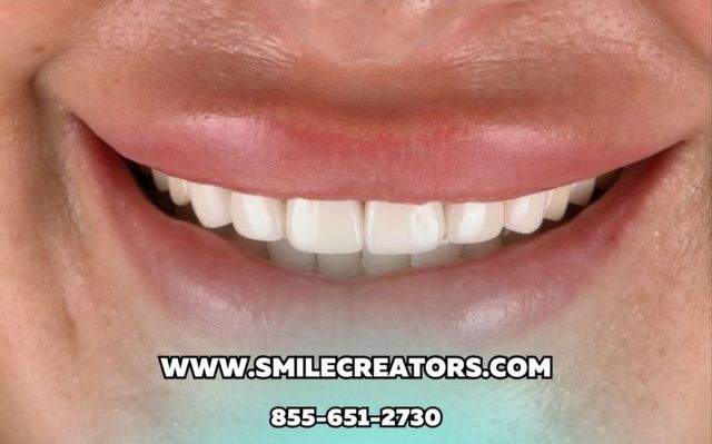 Smile Transformations | Smile Creators | Bay Harbor Islands, FL