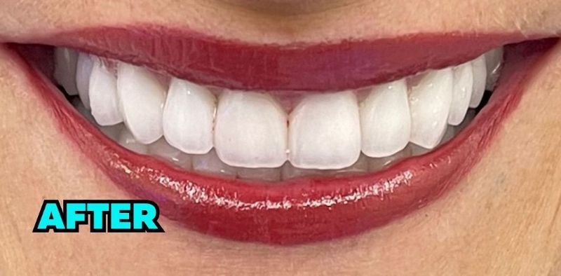A close up of a woman 's smile with white teeth and red lipstick.