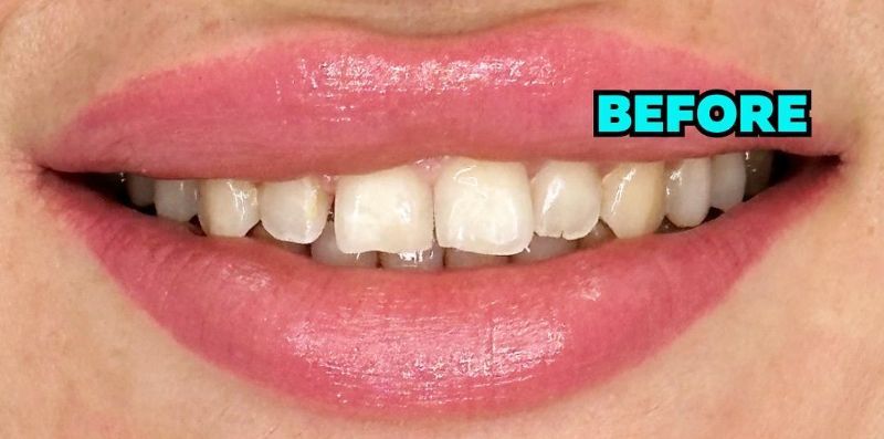 A close up of a woman 's mouth with white teeth and pink lips.