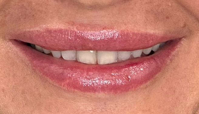 A close up of a woman 's mouth with white teeth and pink lips.