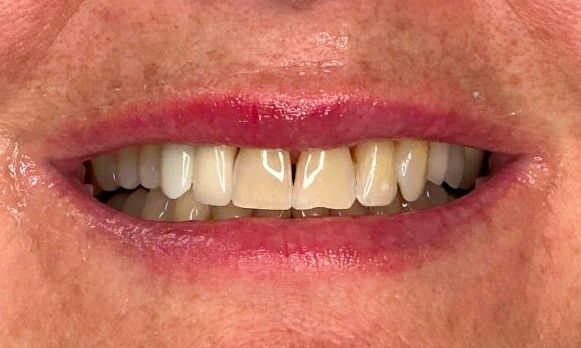 A close up of a woman 's mouth with white teeth and red lips.