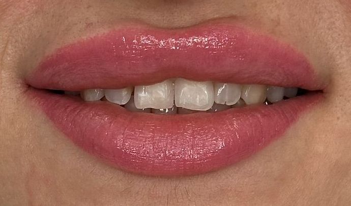 A close up of a woman 's mouth with white teeth and pink lips.