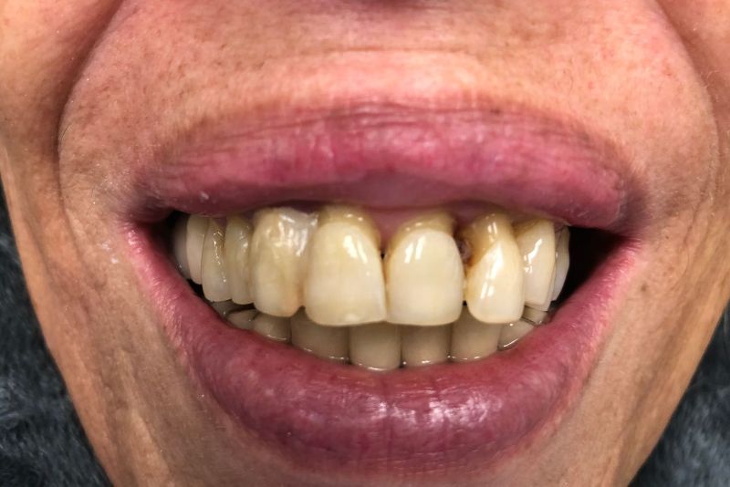 A close up of a woman 's mouth with her teeth showing.