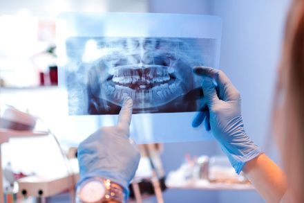 oral surgery