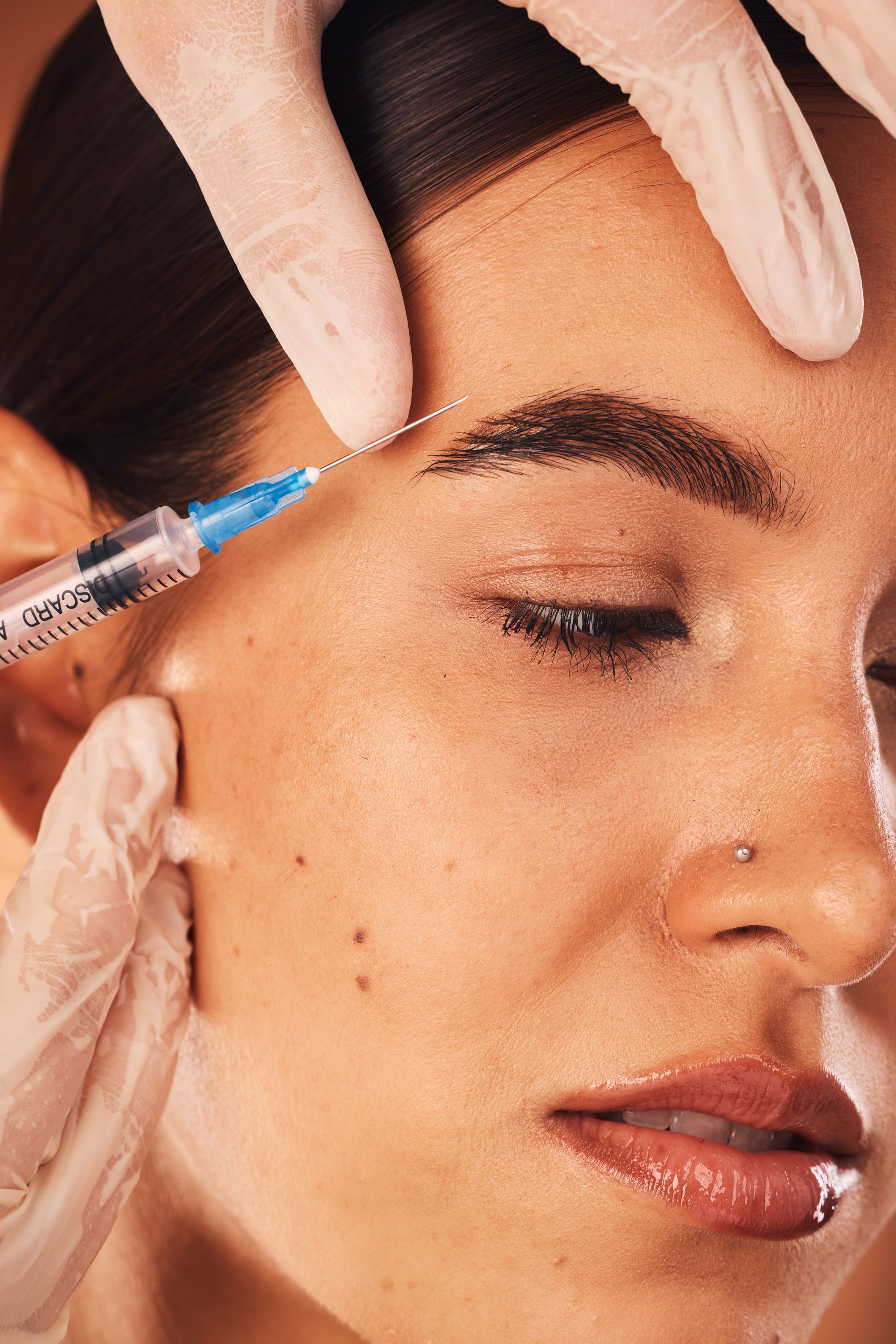 Woman gets BellaFillers