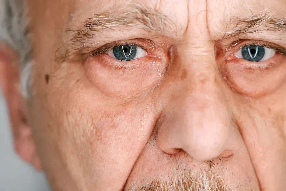 Close-up of an eye with a brown iris, blue ring around the pupil.