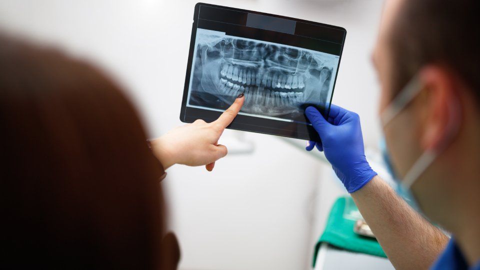 RX articolazione ATM statica e dinamica