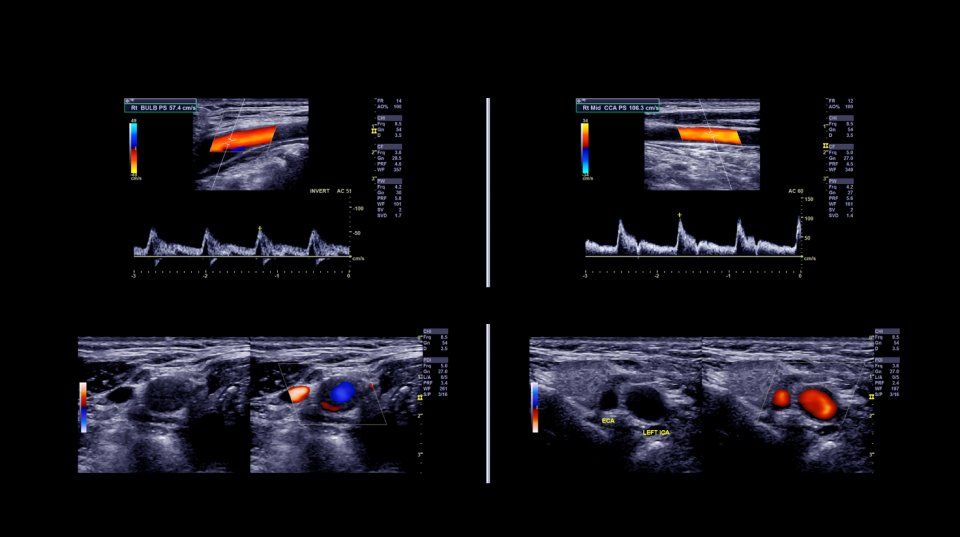 ecocolordoppler