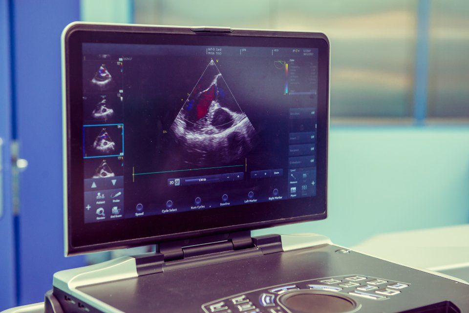 ecocolordoppler cardiaco