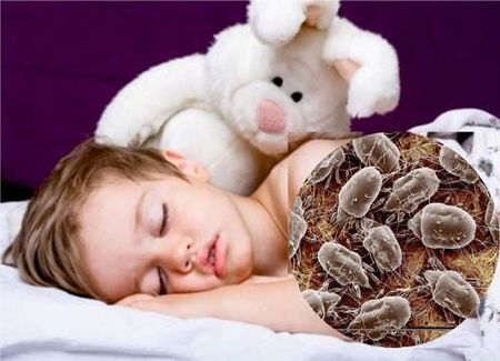 ALERGIAS