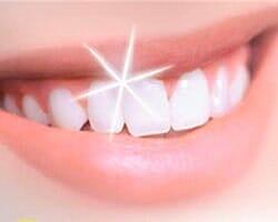 GRUPO HAPPY DENTAL - Blanqueamientos