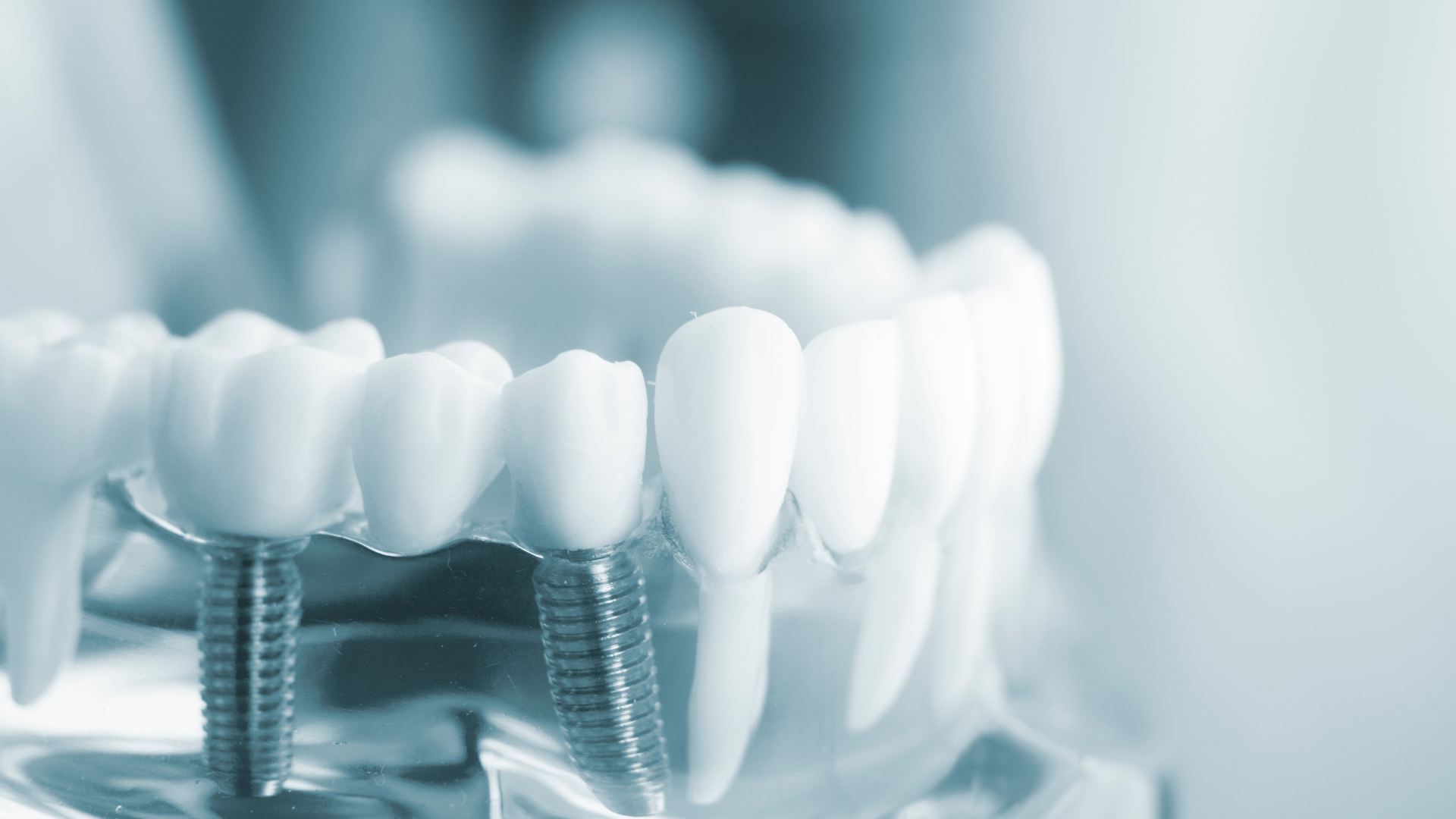 A woman is smiling while sitting in a dental chair.