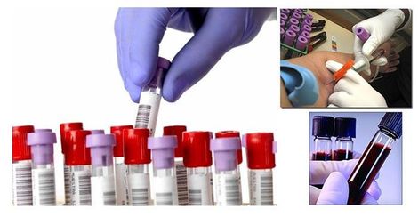 LABORATORIO CLÍNICO BACTERIOLÓGICO PEDRAZA - ANÁLISIS CLÍNICO