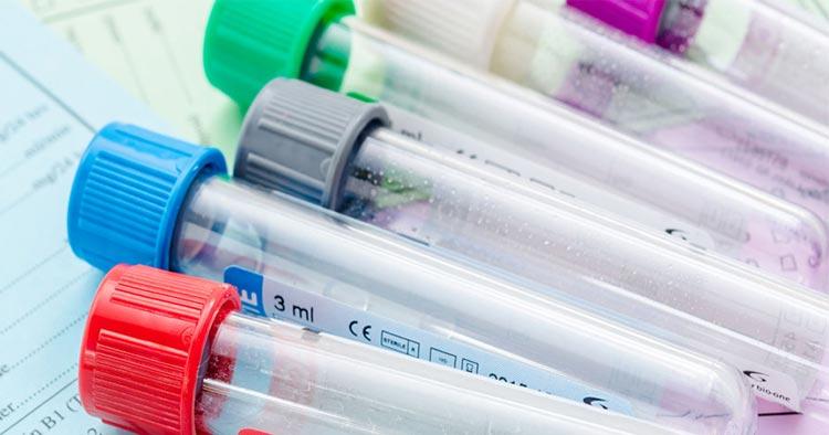 LABORATORIO CLÍNICO BACTERIOLÓGICO PEDRAZA - PRUEBAS DE GLUCOSA