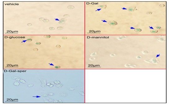 Spermidine ameliorates the neuronal aging by improving the mitochondrial function in vitro