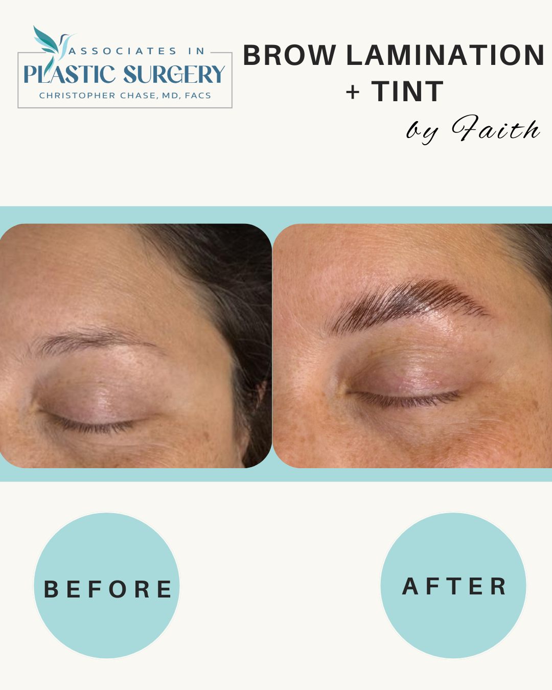 Before-and-after of eyebrow lamination + tint. Left: sparse brow. Right: Fuller, darker brows.