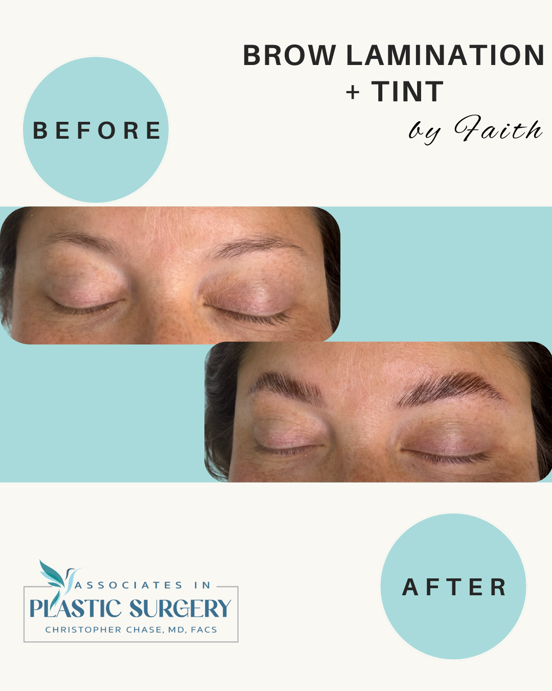 Brow lamination and tint before and after. Light blue background. Darker, fuller brows in the after photo.