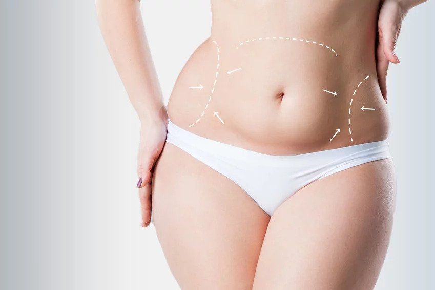 Person in white underwear with dotted contour lines around the waist, suggesting body shaping or slimming.