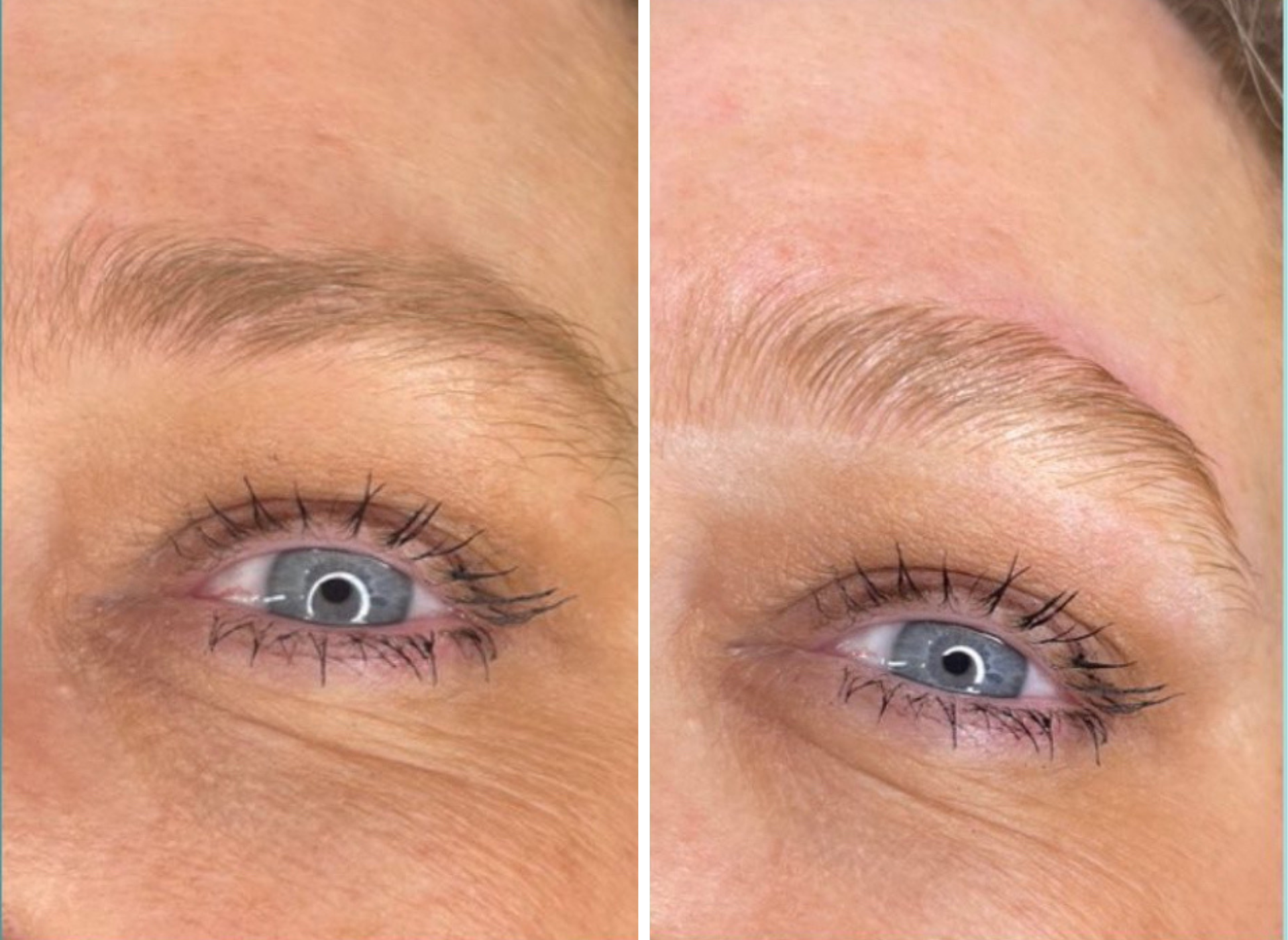 Comparison of eyebrows before and after a brow lift, showing improved shape and lift.