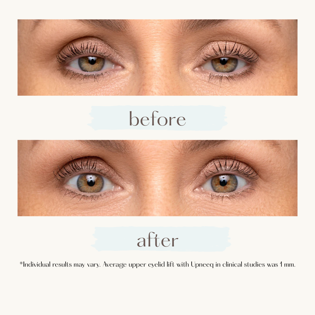 Comparison of eyes before and after applying something to the eyelashes. The 'after' eyes have longer lashes.