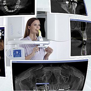 Dentist operating dental X-ray machine with multiple jaw scans displayed on screens