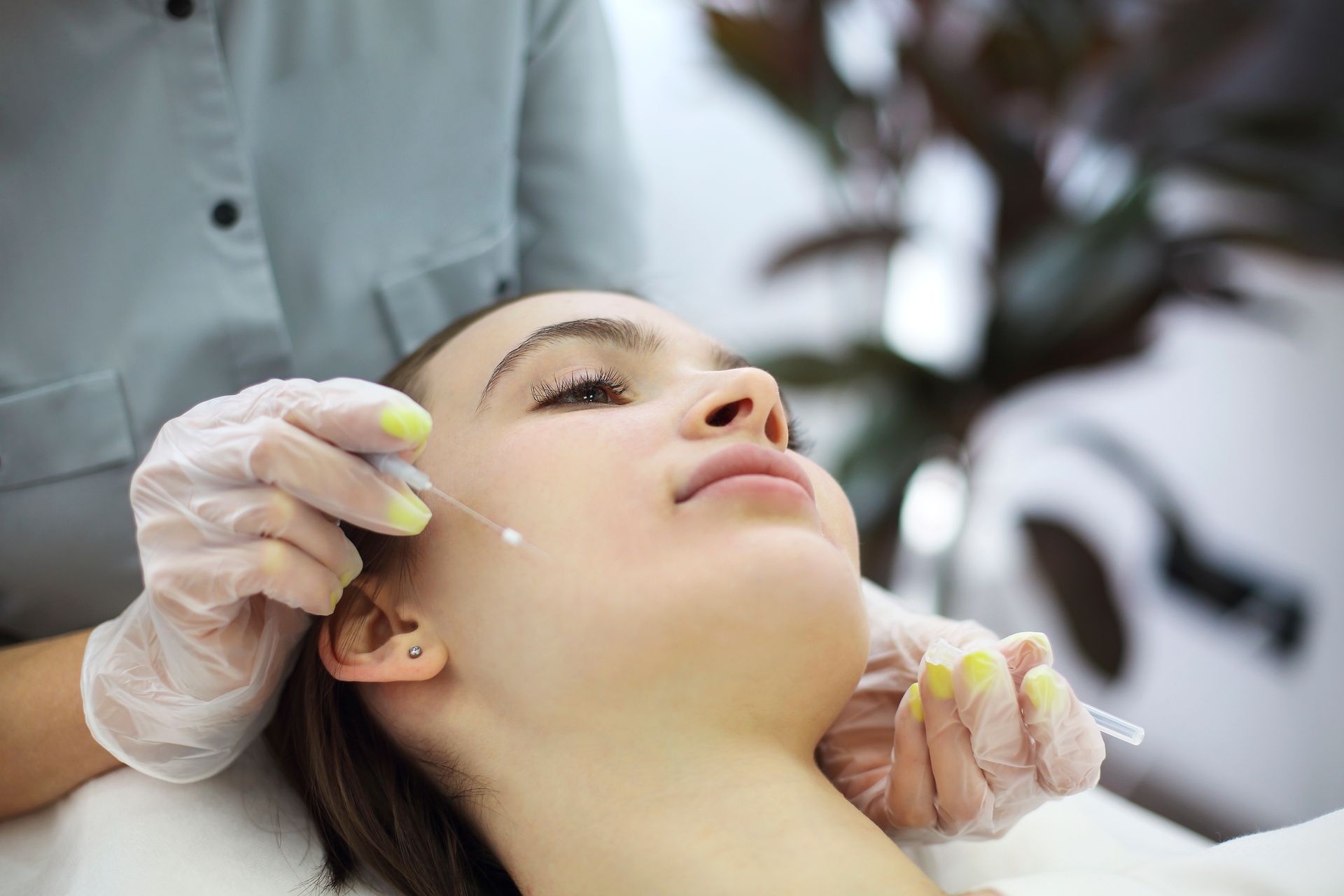 Woman receiving facial acupuncture, with gloved hands holding needles near her face.